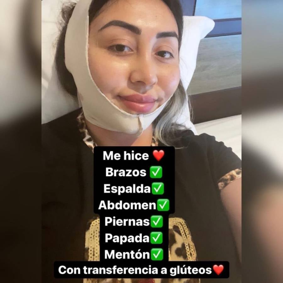 Naya Fácil se sometió a 7 cirugías estéticas en Colombia: «Estoy hinchada  pero todo va bien» | Actualidad | LOS40 Chile