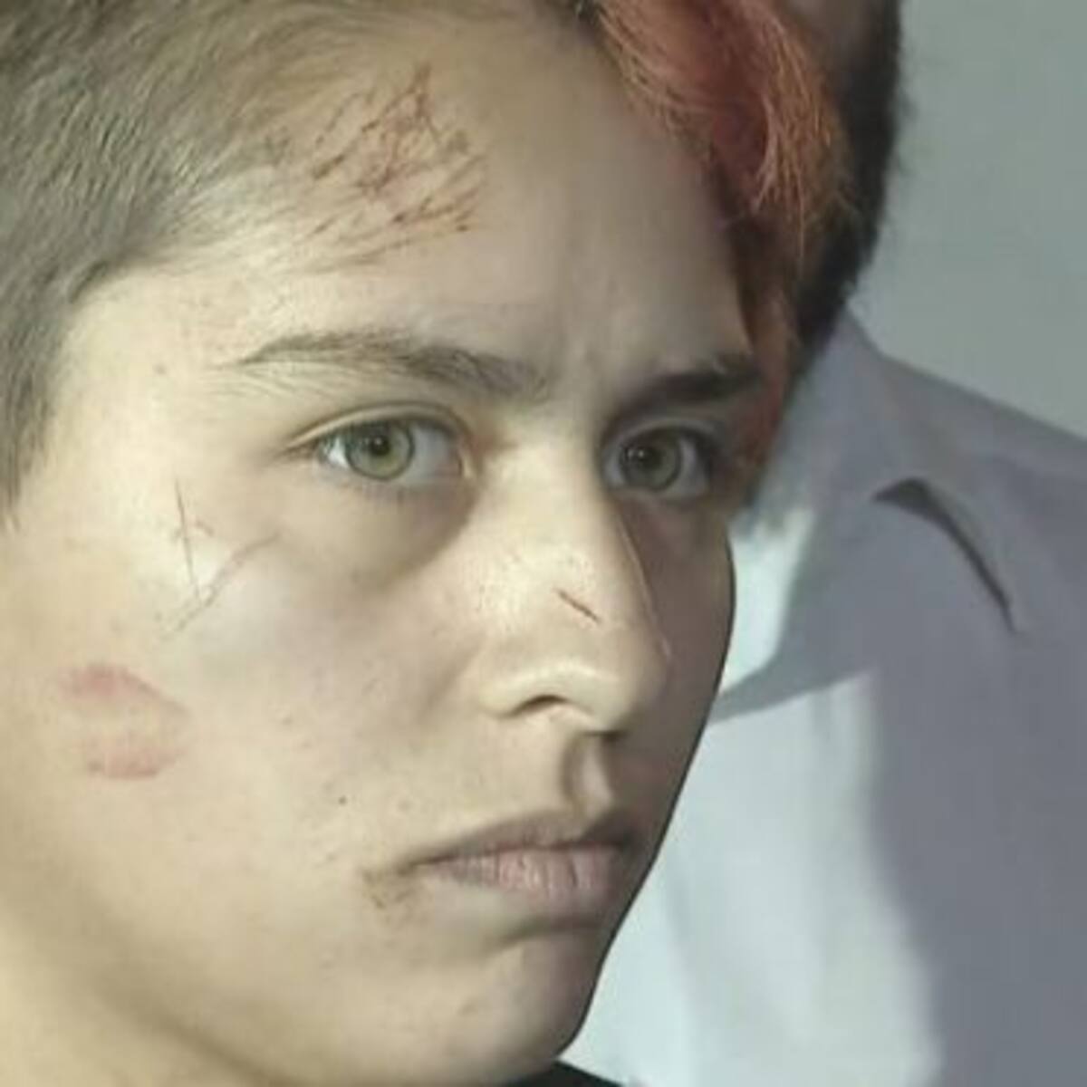 Joven trans fue agredido en Pedro Aguirre Cerda: Fue marcado con esvásticas en su cuerpo