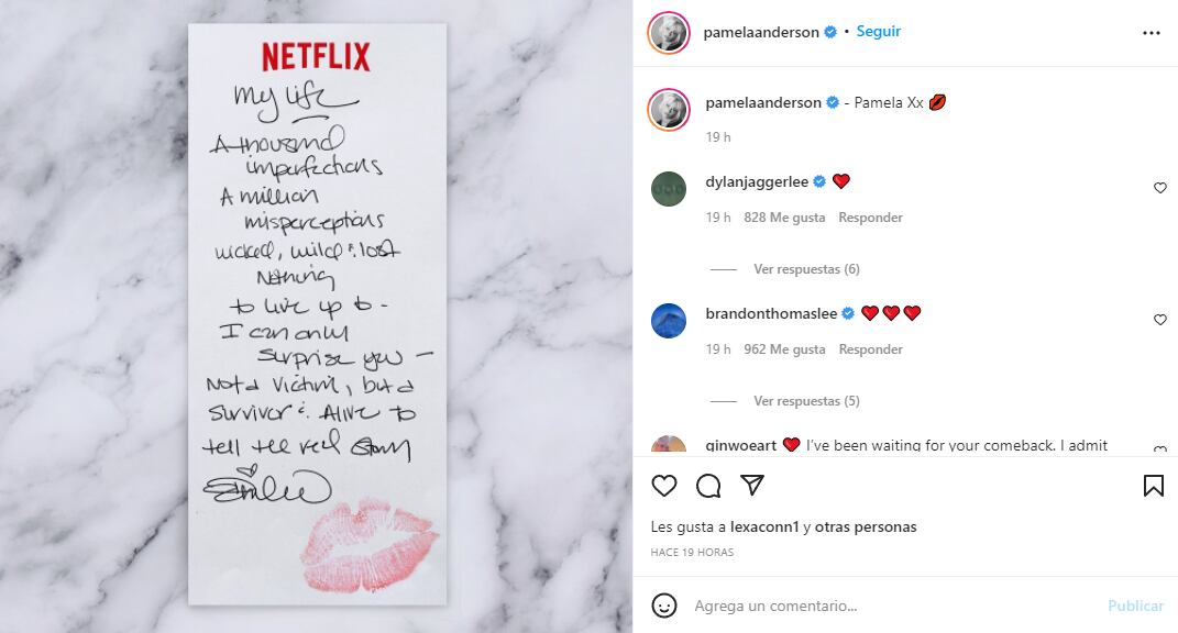 Pamela Anderson Documental