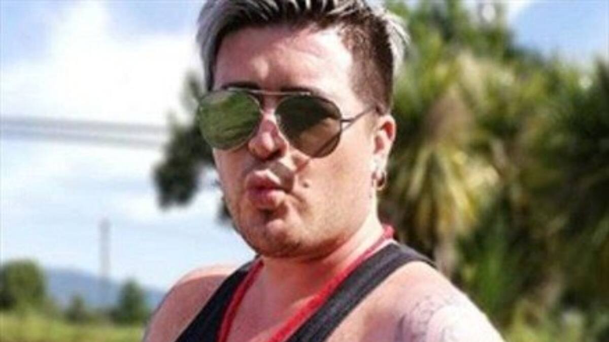 ¡Wow! Junior Playboy muestra su antes y después tras someterse a una rinomodelación