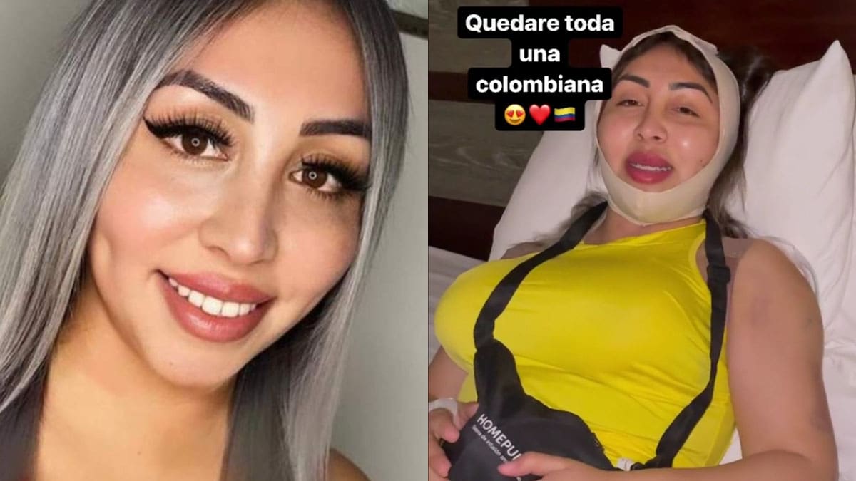 Naya Fácil se sometió a 7 cirugías estéticas en Colombia: «Estoy hinchada pero todo va bien»