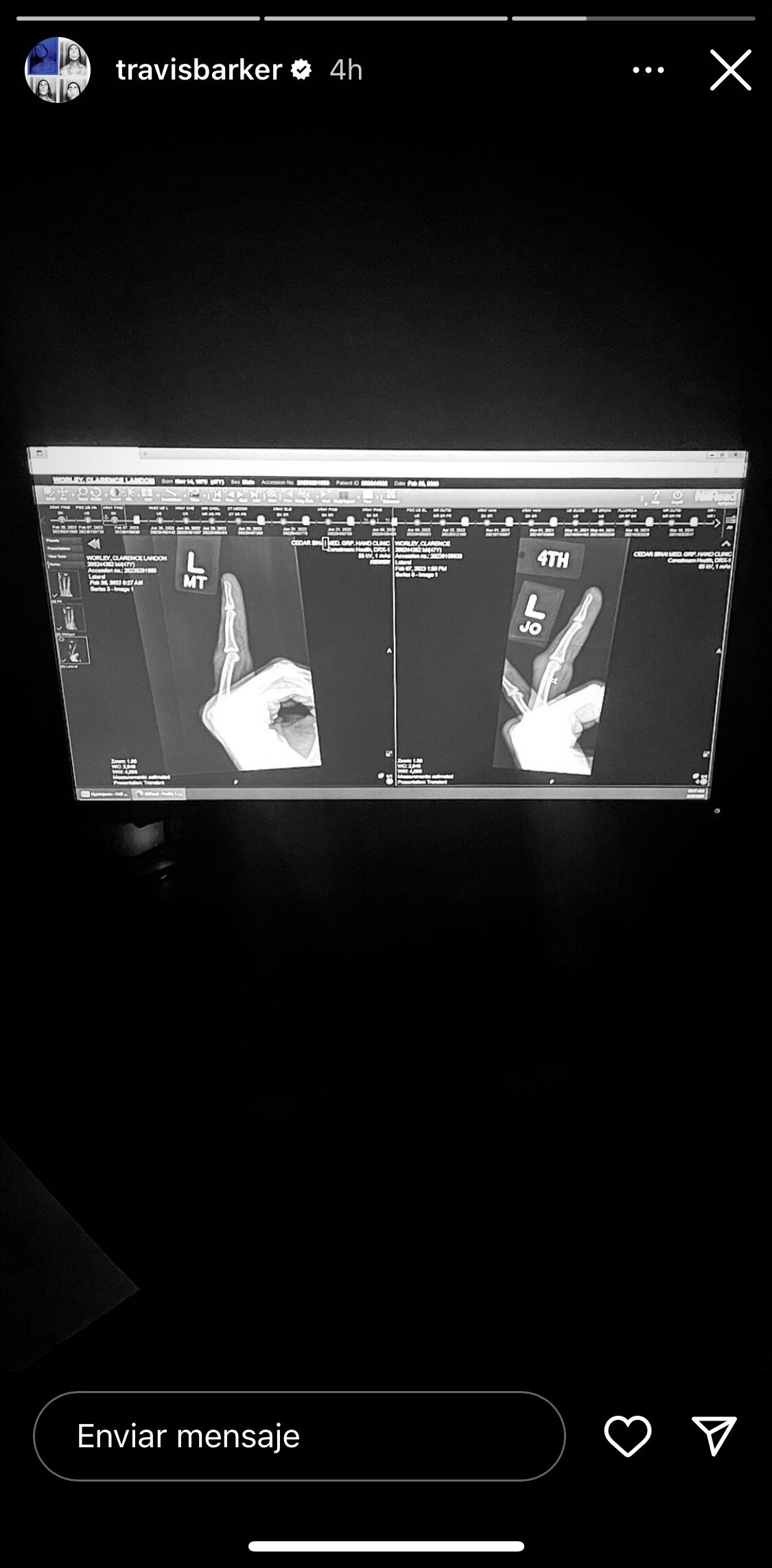 Instagram @travisbarker