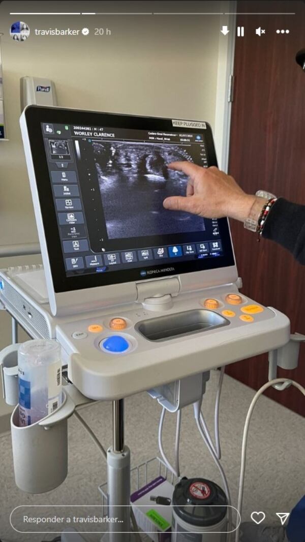 Captura Instagram @travisbarker