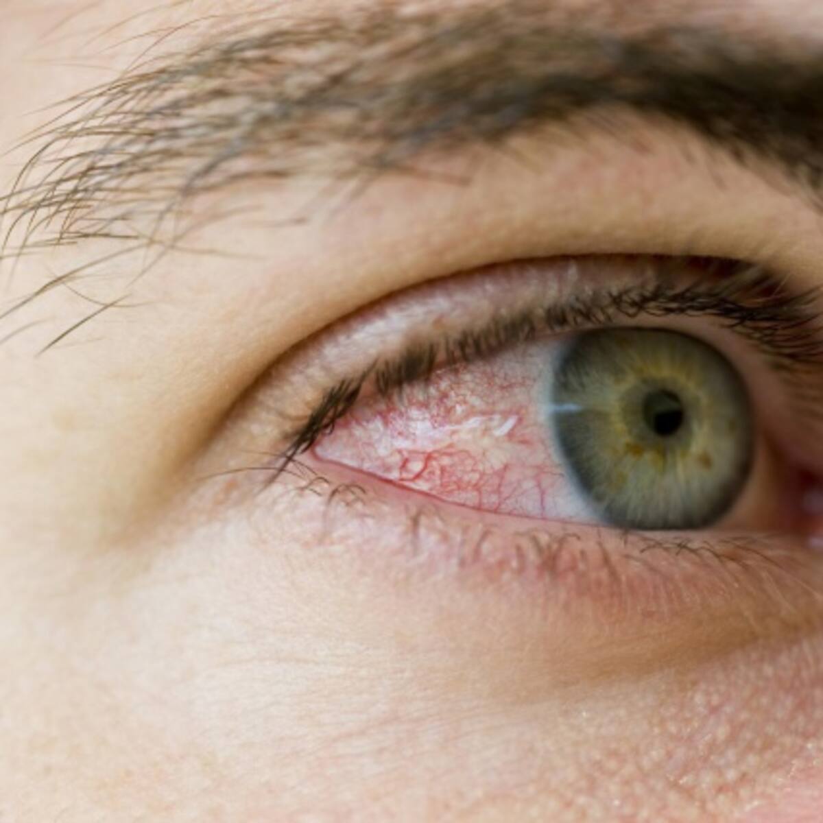 ¿Por qué los ojos se ponen rojos al fumar marihuana?