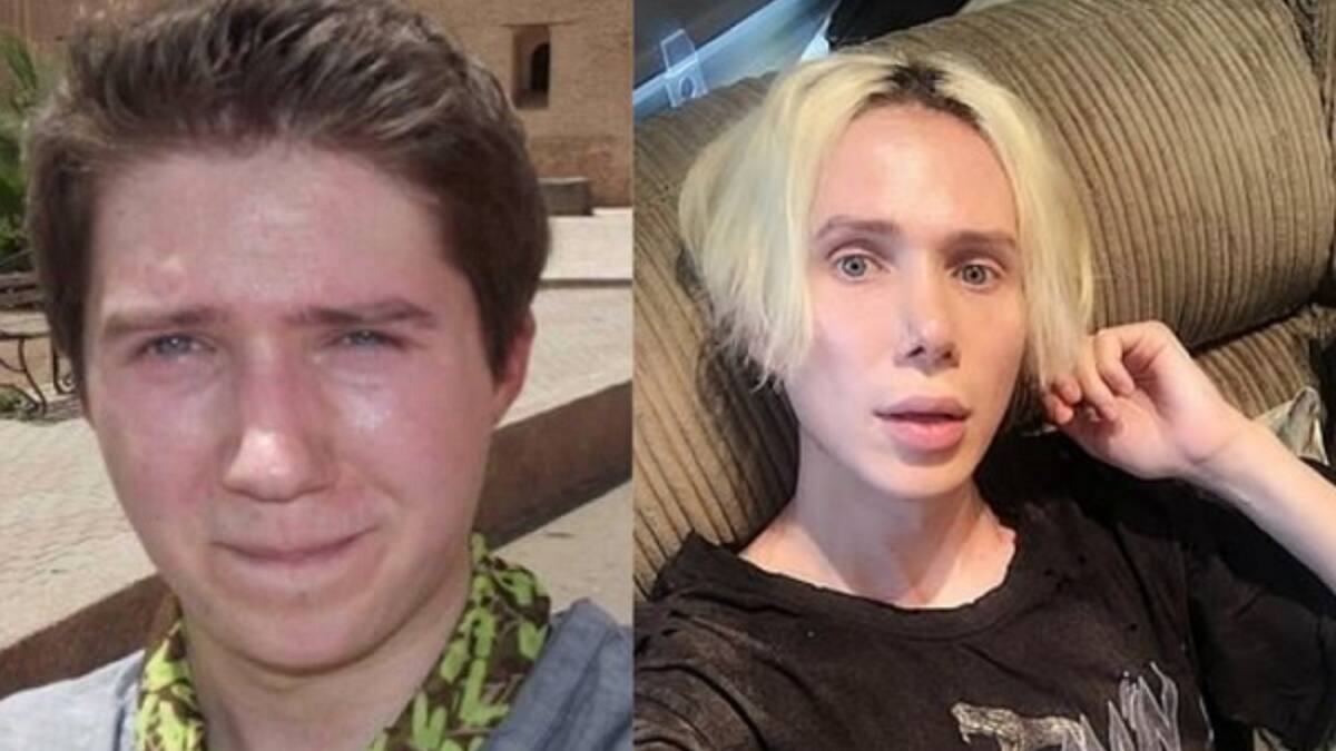 Oli London: El antes y después del británico operado 18 veces para parecerse a cantante de BTS