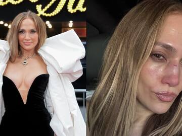 Jennifer López sufre importante caída en la previa de los AMAs 2025