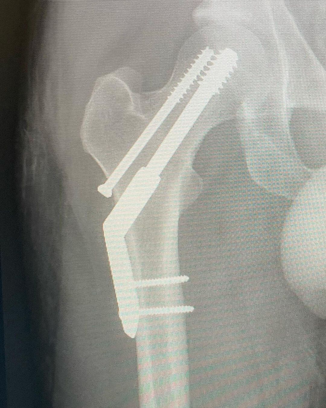 Fuente: Instagram/ @Tameimpala